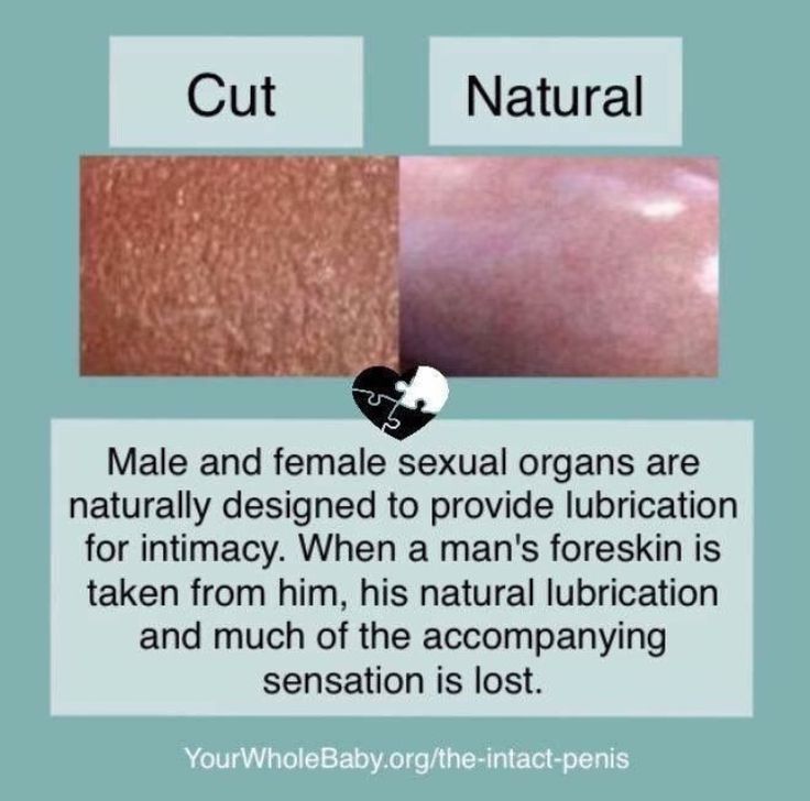 Circumcised Vs Uncircumcised Diagram How To Care For An Unci Circumcised Vs Uncircumcised Diagram How To Care For An Unci